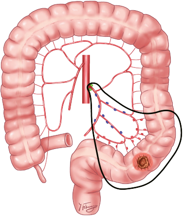 Intestines Intestines